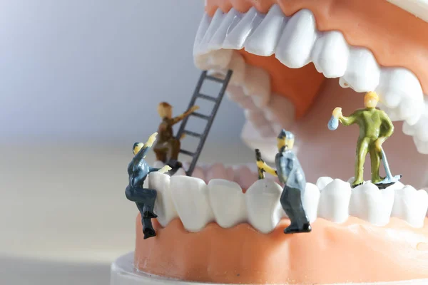 Minyatür insanlar veya küçük figürler tıbbi ve sağlık kavramı olarak diş modeli temizlik. Diş veya diş hekimi fikri için diş modeli üzerinde temizlik ekibi çalışması