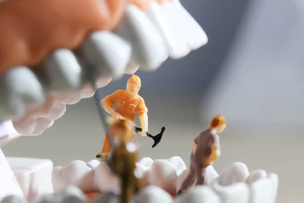 Миниатюрные Люди Маленькие Фигурки Чистящие Зубы Модель Медицинская Медицинская Концепция — стоковое фото