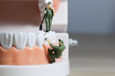 Minyatür insanlar veya küçük figürler tıbbi ve sağlık kavramı olarak diş modeli temizlik. Diş veya diş hekimi fikri için diş modeli üzerinde temizlik ekibi çalışması