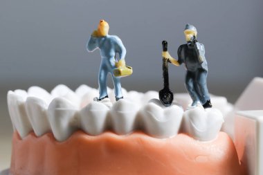 Minyatür insanlar veya küçük figürler tıbbi ve sağlık kavramı olarak diş modeli temizlik. Diş veya diş hekimi fikri için diş modeli üzerinde temizlik ekibi çalışması