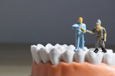 Minyatür insanlar veya küçük figürler tıbbi ve sağlık kavramı olarak diş modeli temizlik. Diş veya diş hekimi fikri için diş modeli üzerinde temizlik ekibi çalışması