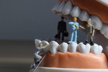 Minyatür insanlar veya küçük figürler tıbbi ve sağlık kavramı olarak diş modeli temizlik. Diş veya diş hekimi fikri için diş modeli üzerinde temizlik ekibi çalışması