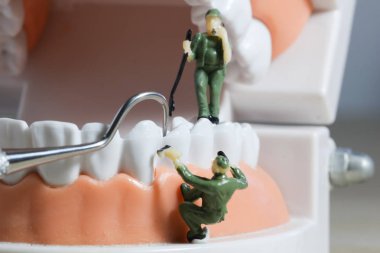 Minyatür insanlar veya küçük figürler tıbbi ve sağlık kavramı olarak diş modeli temizlik. Diş veya diş hekimi fikri için diş modeli üzerinde temizlik ekibi çalışması