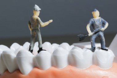 Minyatür insanlar veya küçük figürler tıbbi ve sağlık kavramı olarak diş modeli temizlik. Diş veya diş hekimi fikri için diş modeli üzerinde temizlik ekibi çalışması