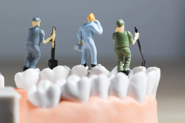Minyatür insanlar veya küçük figürler tıbbi ve sağlık kavramı olarak diş modeli temizlik. Diş veya diş hekimi fikri için diş modeli üzerinde temizlik ekibi çalışması