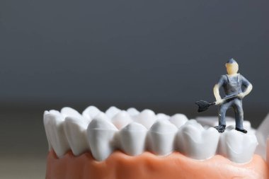 Minyatür insanlar ya da diş temizleyen küçük işçi figürleri tıbbi ve sağlık hizmetleri konsepti olarak kullanılıyor. Temizlik ekibi diş veya diş hekimi fikri üzerinde çalışıyor.