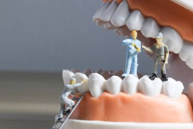 Minyatür insanlar ya da diş temizleyen küçük işçi figürleri tıbbi ve sağlık hizmetleri konsepti olarak kullanılıyor. Temizlik ekibi diş veya diş hekimi fikri üzerinde çalışıyor.