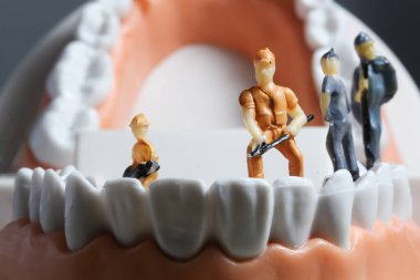 Minyatür insanlar ya da diş temizleyen küçük işçi figürleri tıbbi ve sağlık hizmetleri konsepti olarak kullanılıyor. Temizlik ekibi diş veya diş hekimi fikri üzerinde çalışıyor.