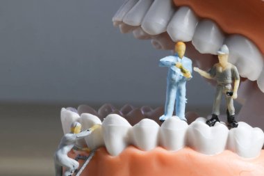 Minyatür insanlar ya da diş temizleyen küçük işçi figürleri tıbbi ve sağlık hizmetleri konsepti olarak kullanılıyor. Temizlik ekibi diş veya diş hekimi fikri üzerinde çalışıyor.