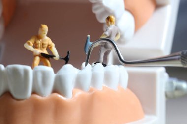 Minyatür insanlar ya da diş temizleyen küçük işçi figürleri tıbbi ve sağlık hizmetleri konsepti olarak kullanılıyor. Temizlik ekibi diş veya diş hekimi fikri üzerinde çalışıyor.