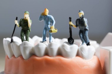 Minyatür insanlar ya da diş temizleyen küçük işçi figürleri tıbbi ve sağlık hizmetleri konsepti olarak kullanılıyor. Temizlik ekibi diş veya diş hekimi fikri üzerinde çalışıyor.