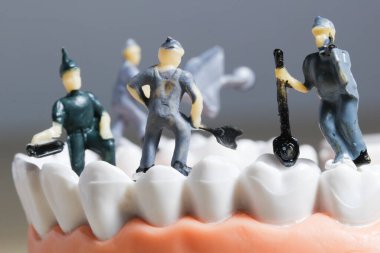 Minyatür insanlar ya da diş temizleyen küçük işçi figürleri tıbbi ve sağlık hizmetleri konsepti olarak kullanılıyor. Temizlik ekibi diş veya diş hekimi fikri üzerinde çalışıyor.