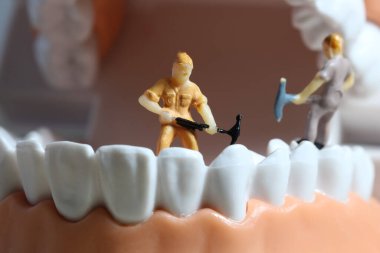 Minyatür insanlar ya da diş temizleyen küçük işçi figürleri tıbbi ve sağlık hizmetleri konsepti olarak kullanılıyor. Temizlik ekibi diş veya diş hekimi fikri üzerinde çalışıyor.