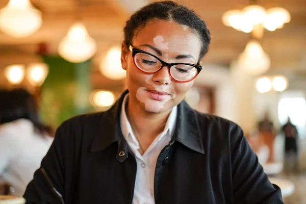 A beautiful young girl of African ethnicity with vitiligo sitting in a restaurant — Stock Photo, Image