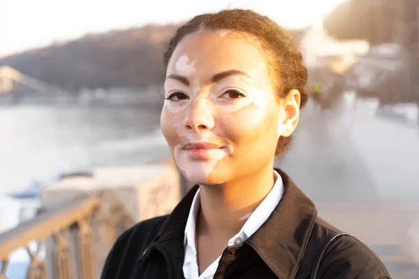 Uma bela jovem de etnia africana com vitiligo em pé na rua quente cidade primavera vestido casaco preto — Fotografia de Stock