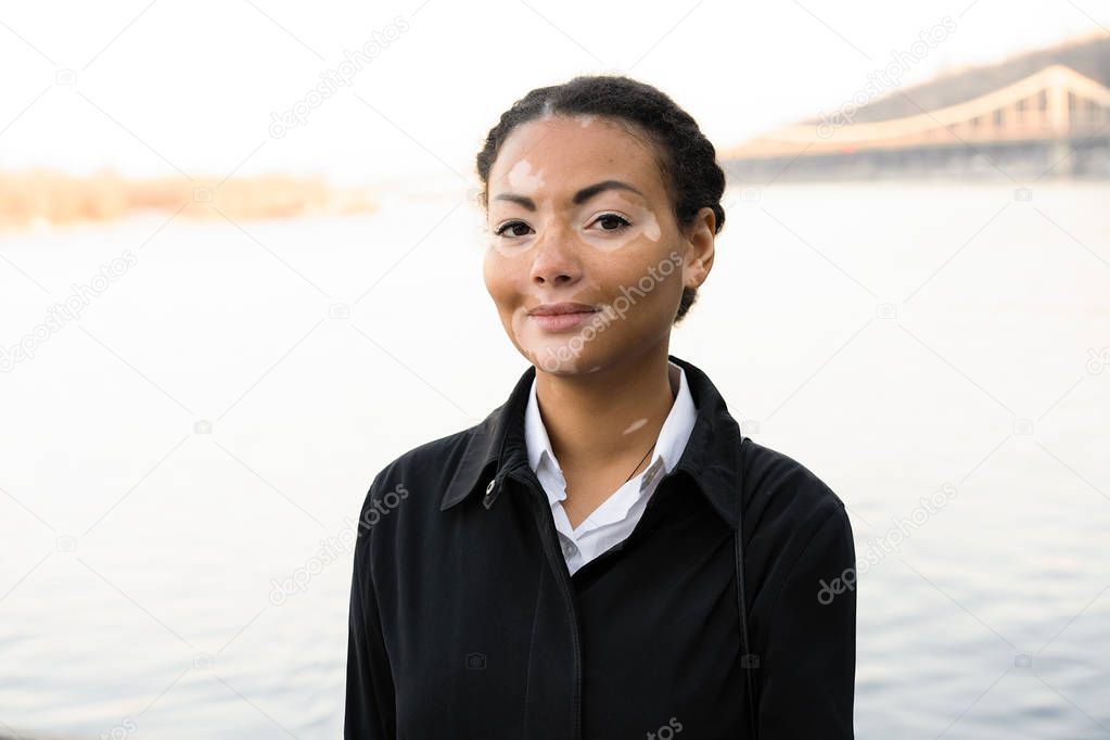 A beautiful young girl of African ethnicity with vitiligo standing on the warm spring city street dressed black coat