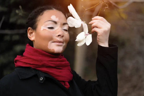 Schöne afrikanische Mädchen mit Vitiligo steht auf der Straße riecht Frühlingsblumen. — Stockfoto