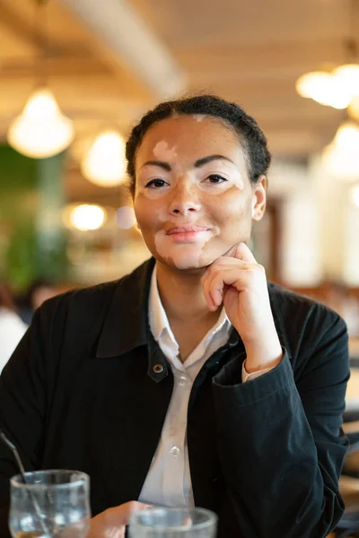 Ein schönes junges Mädchen afrikanischer Herkunft mit Vitiligo sitzt in einem Restaurant — Stockfoto