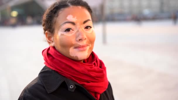 Belle fille africaine avec vitiligo debout dans la rue parlant et souriant . — Video