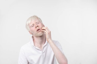 beyaz bir arka plan üzerinde izole t-shirt giyinmiş stüdyoda bir albino adam portresi. anormal sapmalar. sıradışı görünüm