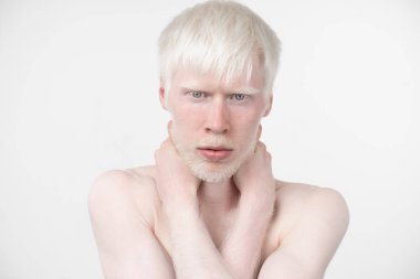 beyaz bir arka plan üzerinde izole t-shirt giyinmiş stüdyoda bir albino adam portresi. anormal sapmalar. sıradışı görünüm