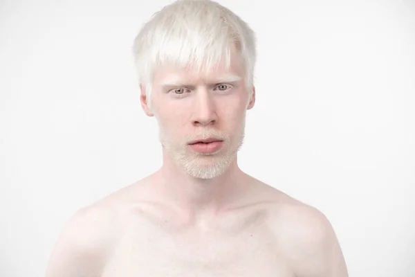 Retrato de un hombre albino en estudio vestido camiseta aislada sobre un fondo blanco. desviaciones anormales. aspecto inusual —  Fotos de Stock