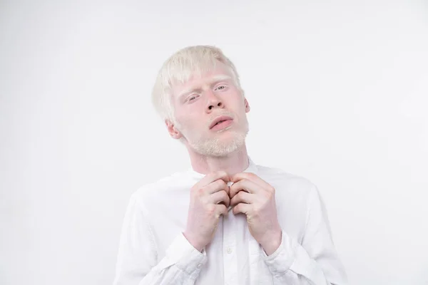 Retrato de un hombre albino en estudio vestido camiseta aislada sobre un fondo blanco. desviaciones anormales. aspecto inusual —  Fotos de Stock