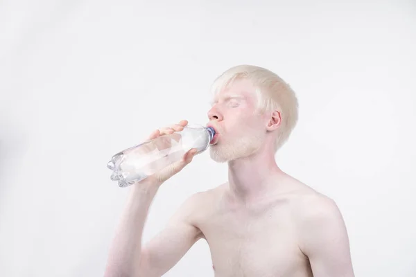 Portrait d'un homme albinos en studio vêtu d'un t-shirt isolé sur fond blanc. écarts anormaux. apparence inhabituelle — Photo