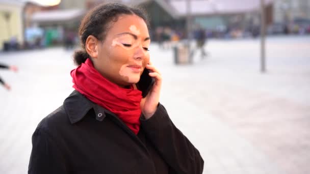 Schönes afrikanisches Mädchen mit Vitiligo, das auf der Straße steht, Handy spricht und lächelt. — Stockvideo