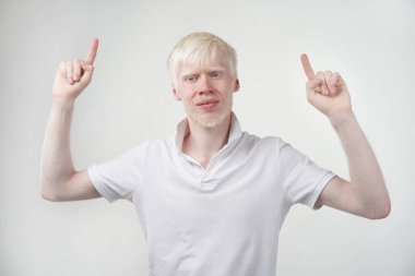 Albinizm albino adam beyaz saç stüdyosu tişört giymişti beyaz arka plan anormallikleri alışılmadık görünüş anormallikleri Güzel insanlar iki parmağını kaldırır.