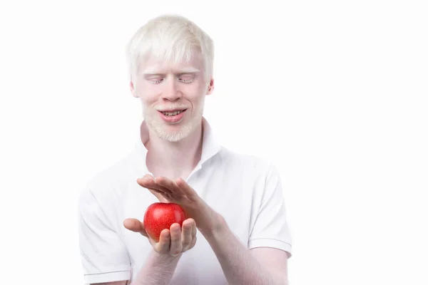 白化病白化病男子白色皮肤头发工作室穿着T恤孤立的白色背景 不正常的偏差不寻常的外表皮肤异常漂亮 外表特殊的人 吃红苹果 — 图库照片