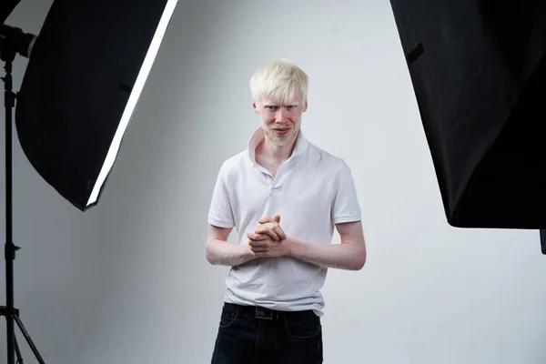 Альбинизм Серьезный Альбинос Человек Белокожий Парикмахерская Одета Футболка Стоя Вспышка — стоковое фото