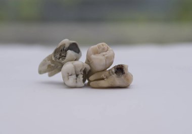 Tüm insan dişleri hakkında. 