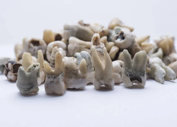 Όλα Σχετικά Ανθρώπινα Δόντια — Φωτογραφία Αρχείου