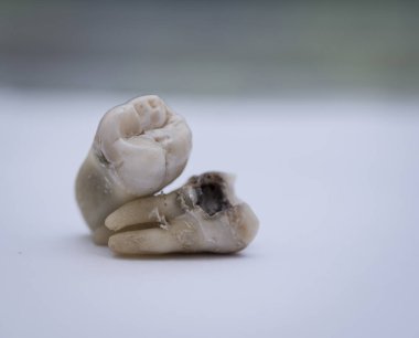 Tüm insan dişleri hakkında. 