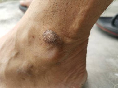 bacak ve ayak insan vücut parçaları ile yakın