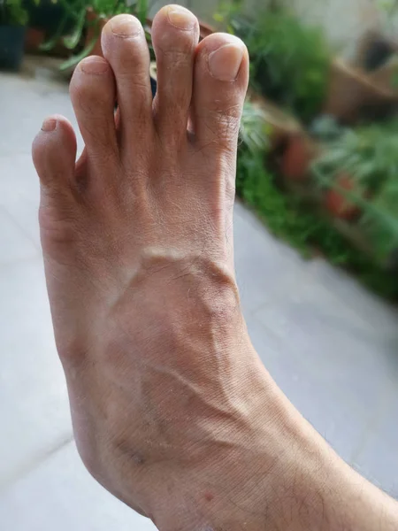 Close Human Bodious Parts Leg Foot — стоковое фото