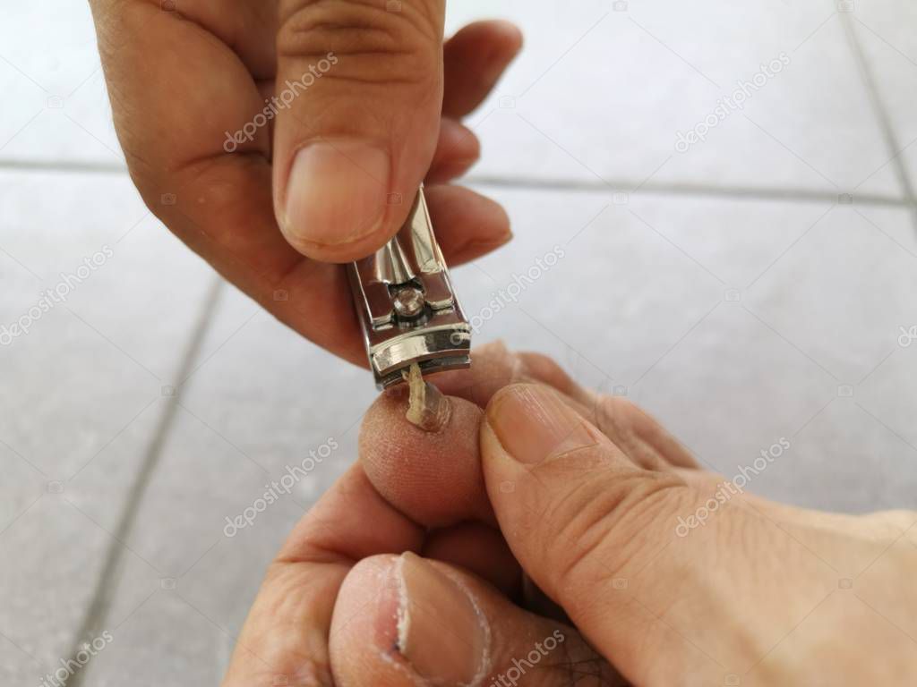 clipping out extra long foot nail