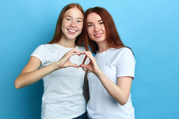 Two best friends showing their warm tender feeling, friendship — Stock Photo, Image