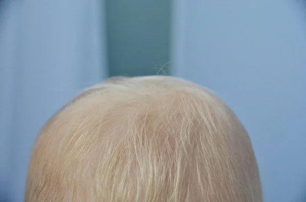 Soft White Baby Hair Blue Background — Stock Photo, Image