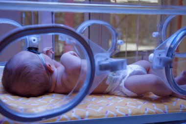 Yeni doğmuş bir bebek sarılık