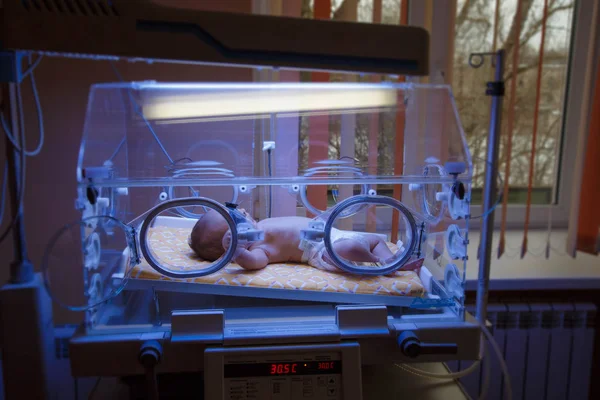 Yeni doğmuş bir bebek sarılık