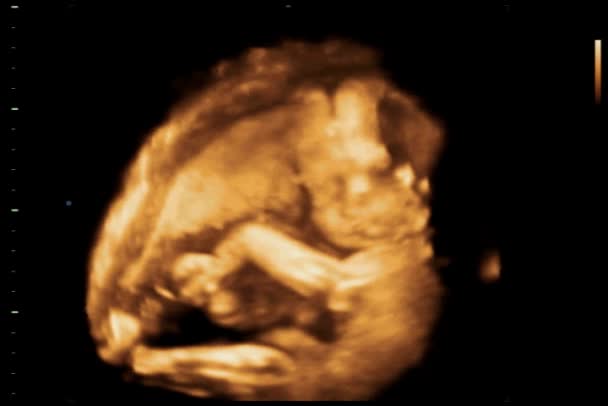 Badanie Ultrasonograficzne Dziecka — Wideo stockowe