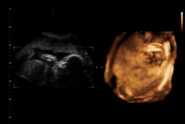 Baby Ultrasound Exam — Stock Video