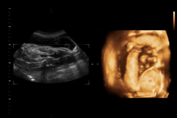 Baby Ultrasound Exam — Stock Video