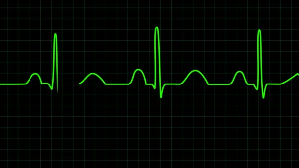 心電図ストック動画 ロイヤリティフリー心電図動画 Depositphotos