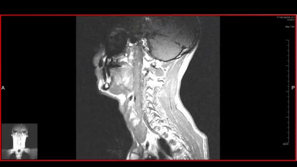 Head Mrt Skanowania Diagnostyczne Narzędzie Medyczne Pętla — Wideo stockowe