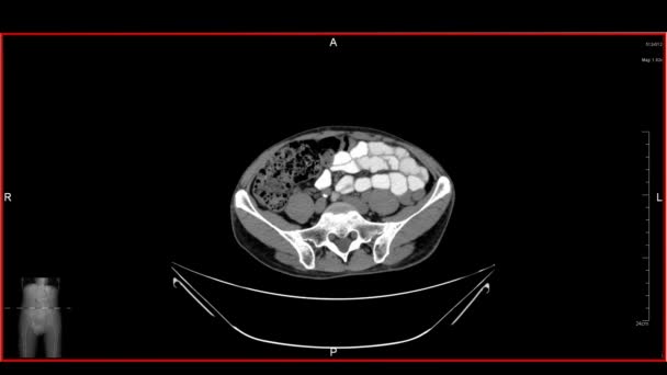 Cat Scan Images Desplazándose Monitor Computadora — Vídeo de stock