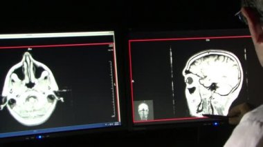 Bilgisayarlı Eksenel Tomografi Tcan Cat. Monitörlerde Doktor Analizi