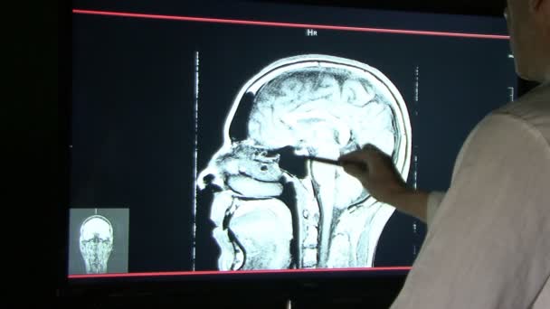 Tomographie Axiale Informatisée Scan Cat Analyse Médecin Dans Les Moniteurs — Video